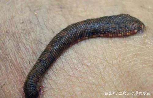 活体蚂蟥在5岁男孩体内存留1年多，体内有蚂蟥会有哪些症状？