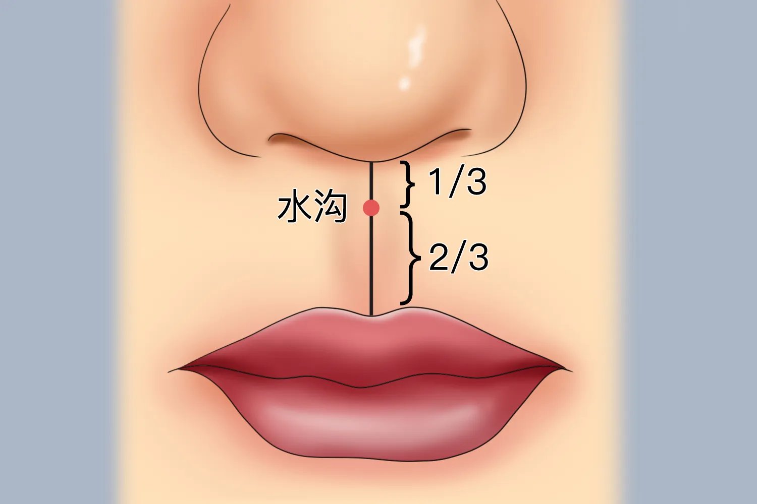 偏瘫的针灸治疗的位置示意图