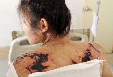 体无完肤是什么意思