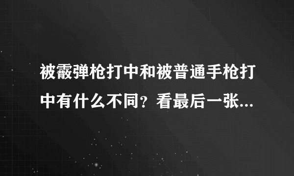 被霰弹枪打中和被普通手枪打中有什么不同？看最后一张图就明白了