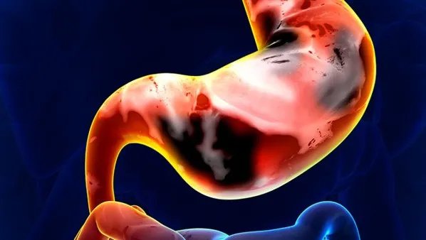 经常胃胀气怎么办