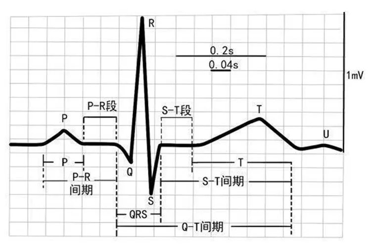 心电图心率计算