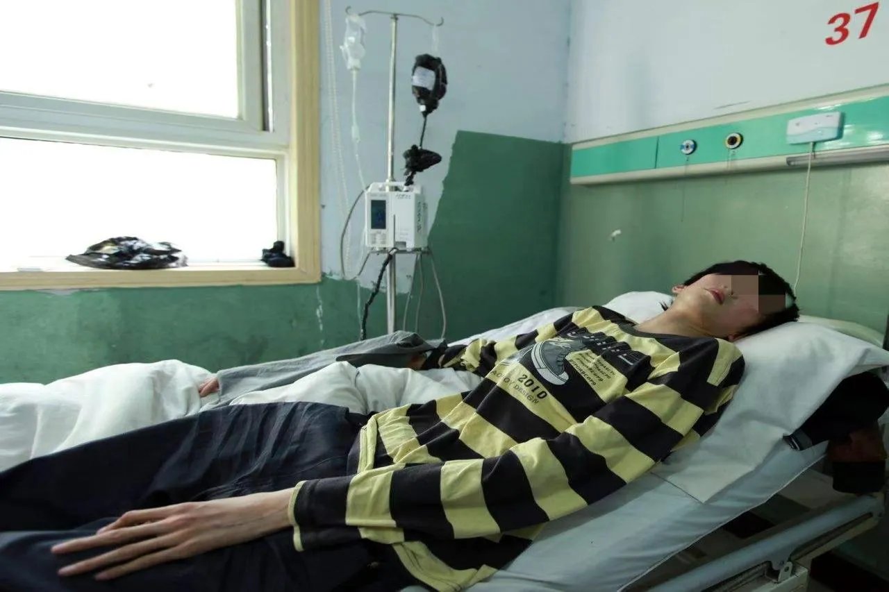 儿童马氏综合症图片