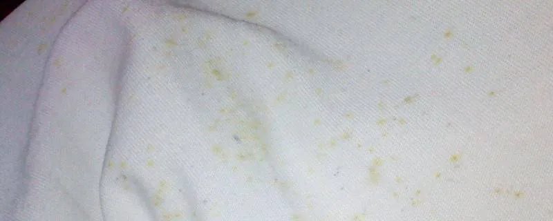 衣服上有霉点怎么清洗