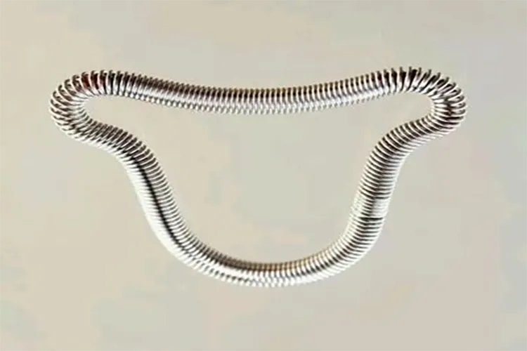 女生避孕环是什么样的