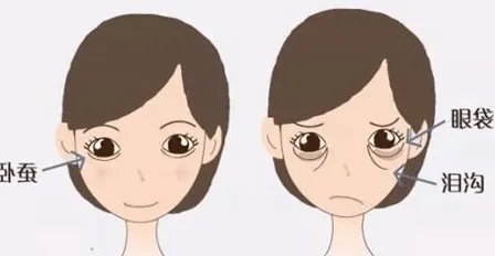 外切眼袋有风险吗?