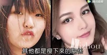 周扬青整容前就跟罗志祥在一起,明星只是整牙？