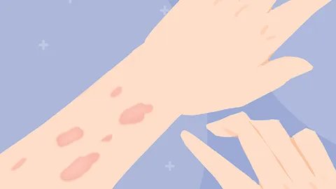 年轻人为什么也长老年斑