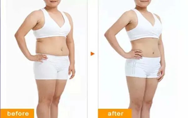 抽脂手术多少钱