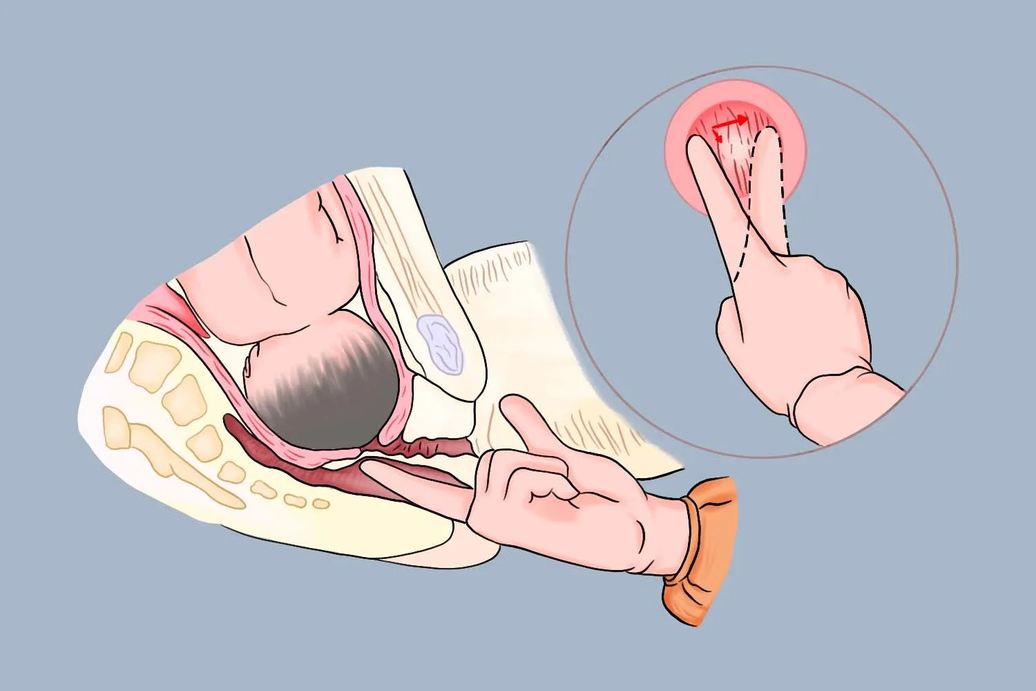 开宫口在哪个位置图