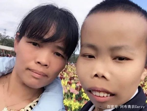 还记得“外星人”陈山吗?被封杀3年之后变化巨大,现在如何了?