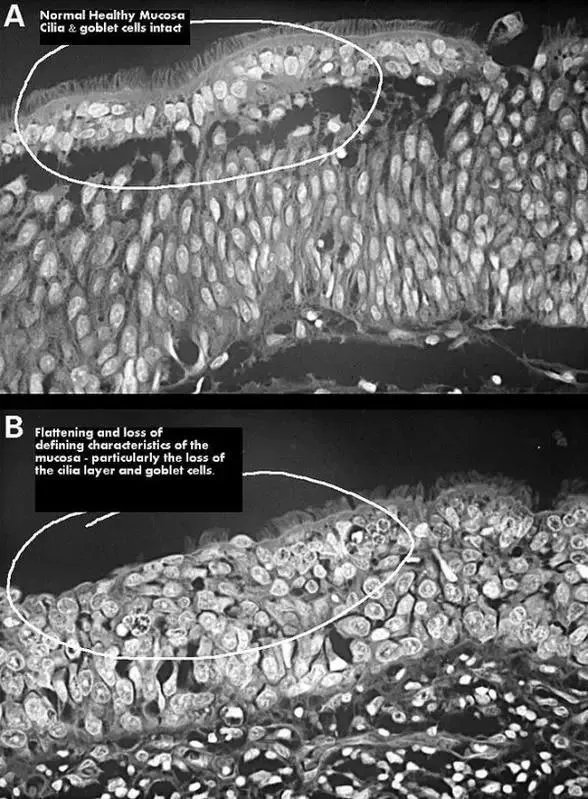 空鼻症是种会呼吸的痛