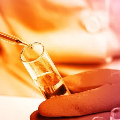 红斑狼疮细胞如何检查？