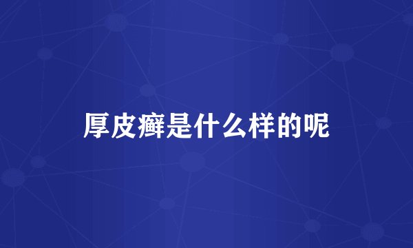 厚皮癣是什么样的呢