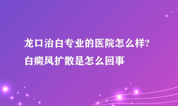 龙口治白专业的医院怎么样?白癜风扩散是怎么回事