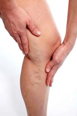 风湿性血管炎多久会严重