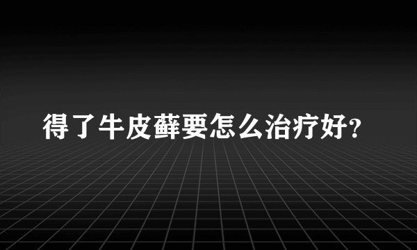 得了牛皮藓要怎么治疗好？