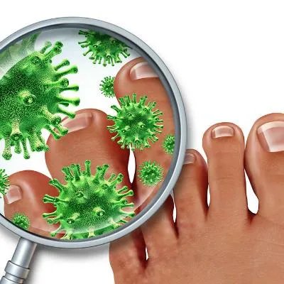 脚气是什么原因呢