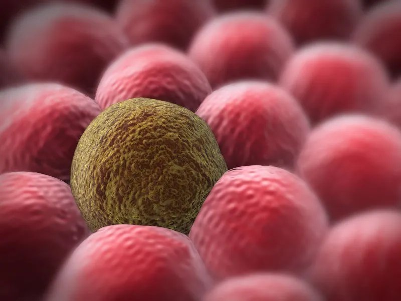 癌症转移怎么办