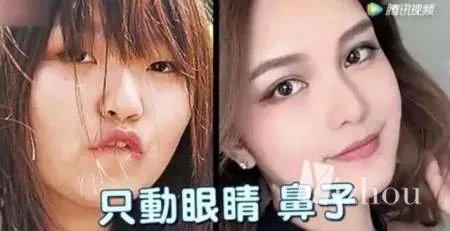 周扬青整容前就跟罗志祥在一起,明星只是整牙？