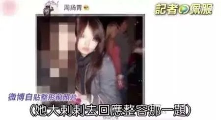 周扬青整容前就跟罗志祥在一起,明星只是整牙？