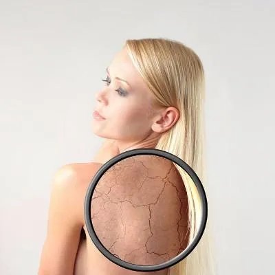 牛皮癣的病因有哪些呢