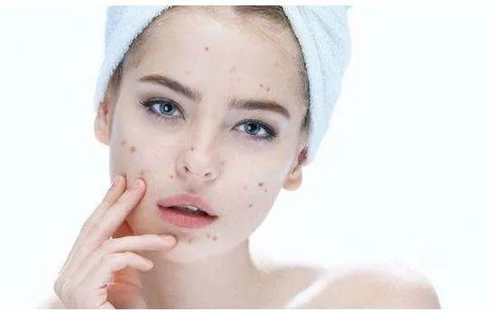 全脸脂肪填充几天消肿?究竟全脸脂肪填充多久可以恢复自然