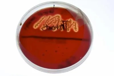 孢子丝菌病怎么得的