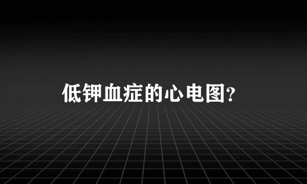 低钾血症的心电图？