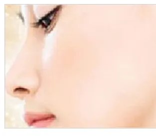 激光去红血丝价格