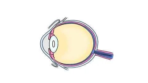 眼结膜下出血有危险吗要怎么治疗