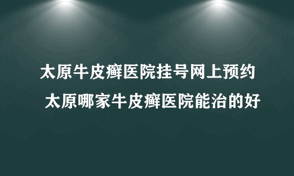 太原牛皮癣医院挂号网上预约 太原哪家牛皮癣医院能治的好