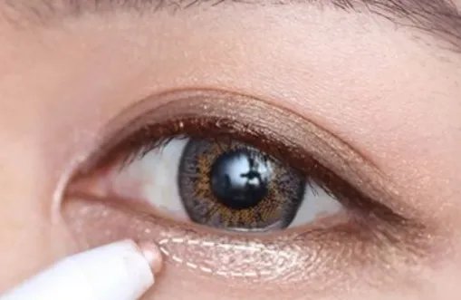 韩式定位双眼皮怎么做