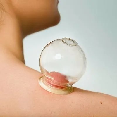 牛皮癣的病因有哪些呢