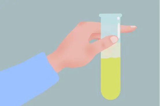 小便有异味是怎么回事