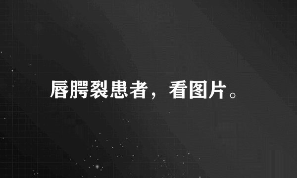 唇腭裂患者，看图片。