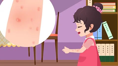 胆碱性荨麻疹的危害