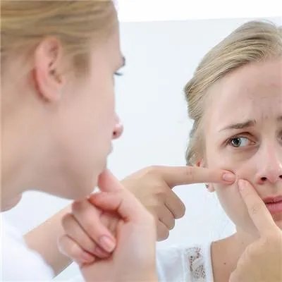 额头长痘是什么原因