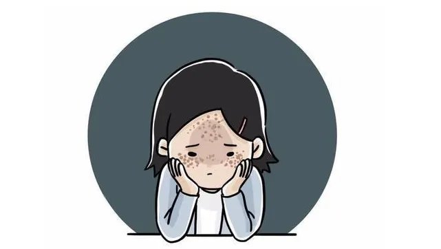 全皮秒祛斑要多少次