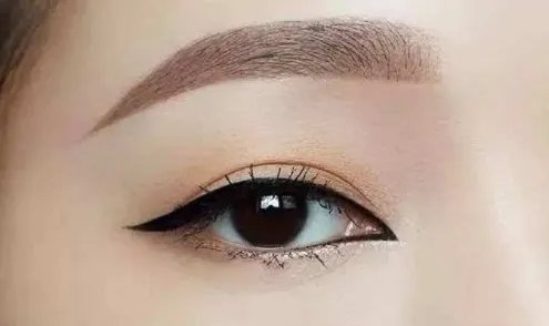 韩式无痕双眼皮的风险