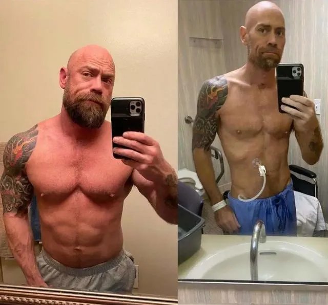 为什么有些年轻的医生感染新冠后去世了，而很多年纪大的患者却能够康复？