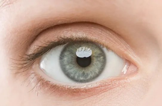 黑眼圈到底是怎么形成的呢