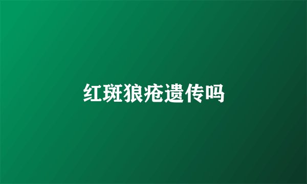 红斑狼疮遗传吗