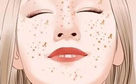 激光祛斑的危害与效果