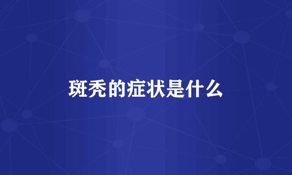 斑秃的症状是什么