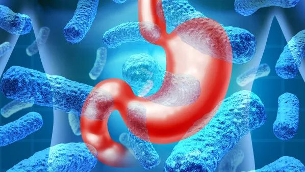 功能性消化不良的症状