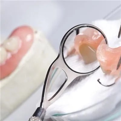 镶牙的种类是哪些