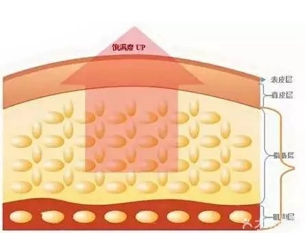 全脸脂肪填充几天消肿?究竟全脸脂肪填充多久可以恢复自然