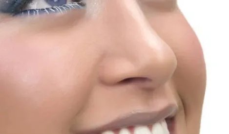 鼻翼缩小大概价格