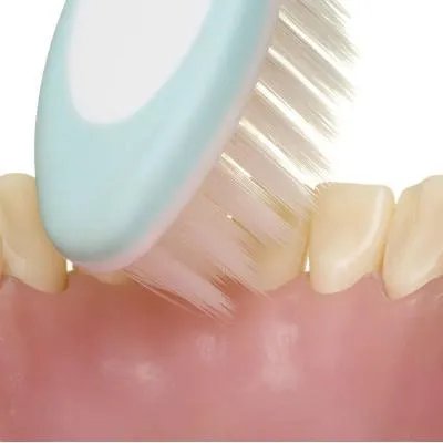 急性智齿冠周炎怎么治疗?